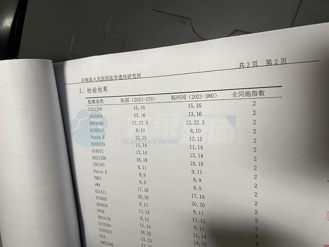 同卵双胞胎_异卵双胞胎和同卵双胞胎_试管双胞胎同卵
