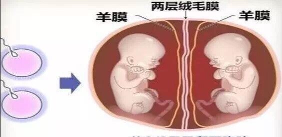 同卵双胞胎_同卵双胞胎_异卵双胞胎