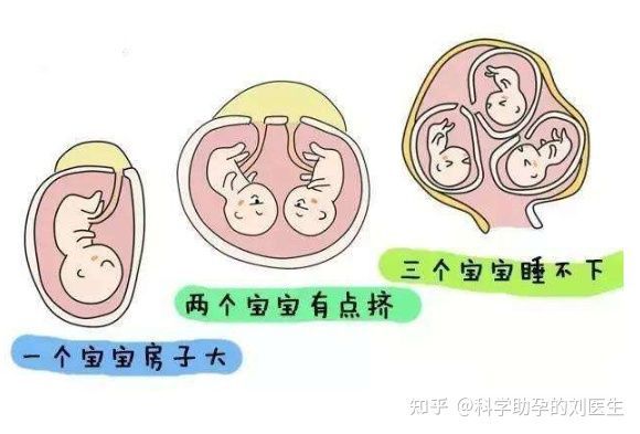 多胎妊娠_足月妊娠胎心率_多胎妊娠减胎注意事项