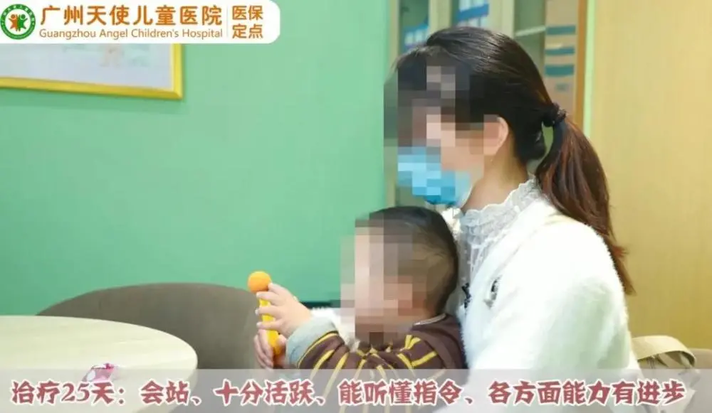 唐氏综合症