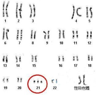 唐氏综合症_牧彤拖延症的自我疗法:七周扫除拖延症^^^好心态好前程:成功_先天愚型 唐氏综合