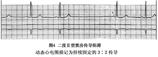丝间舞180期合集下载_征地区片综合地价_短QT间期综合征