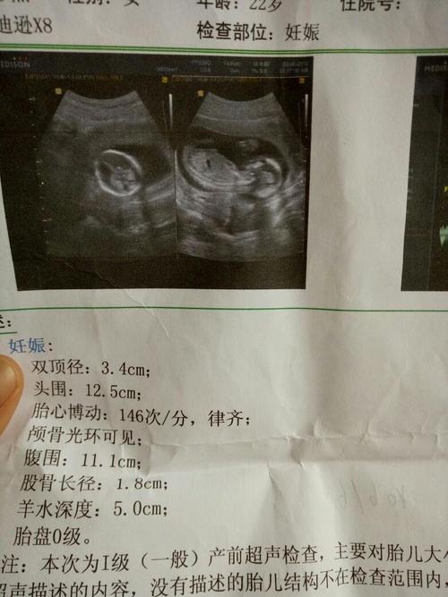 唐氏综合症_囤积症对应的是什么症_牧彤拖延症的自我疗法:七周扫除拖延症^^^好心态好前程:成功