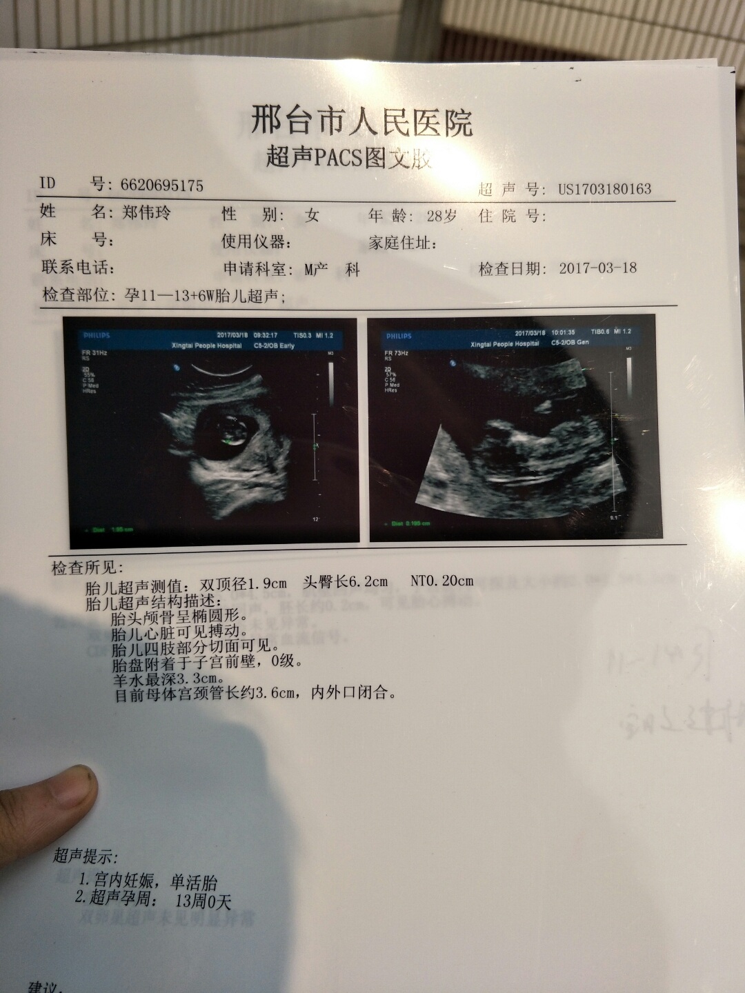 nt检查_nt检查图片_nt检查