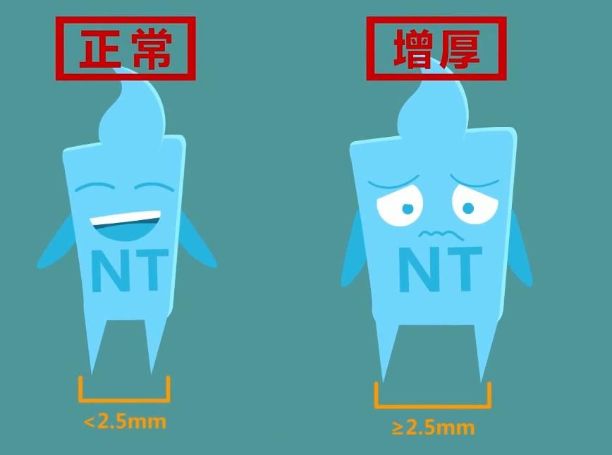 nt检查