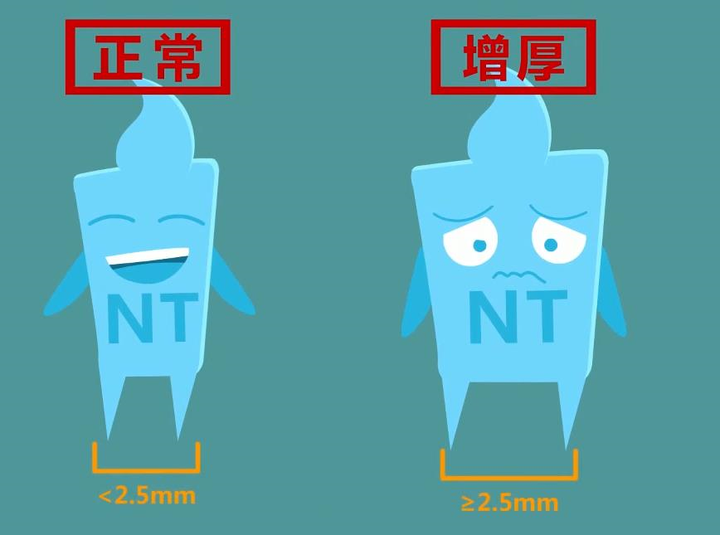 nt检查