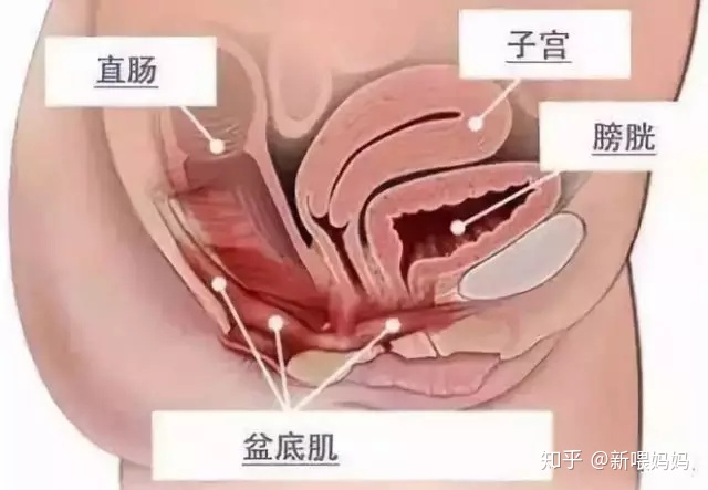 盆底肌修复