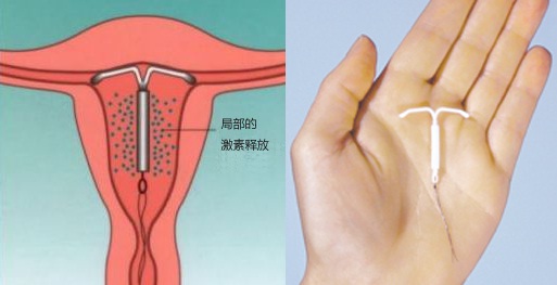 着床降温图_着床降温_着床降温两天