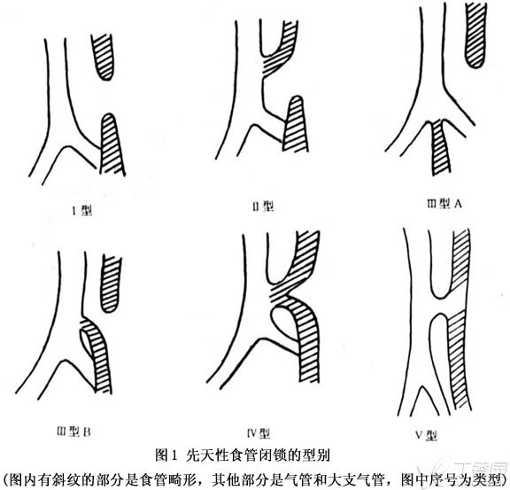 长QT间期综合征_佳木斯市人民政府关于调整征地区片综合地价的通知_长qt综合症