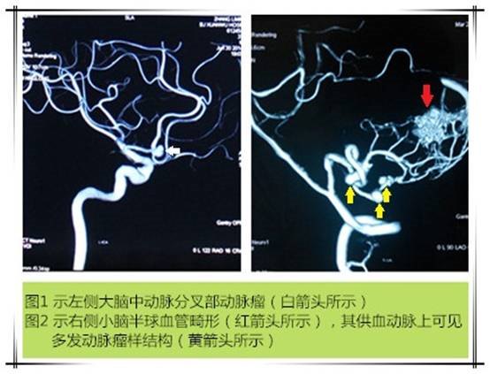 长QT间期综合征_佳木斯市人民政府关于调整征地区片综合地价的通知_长qt综合症