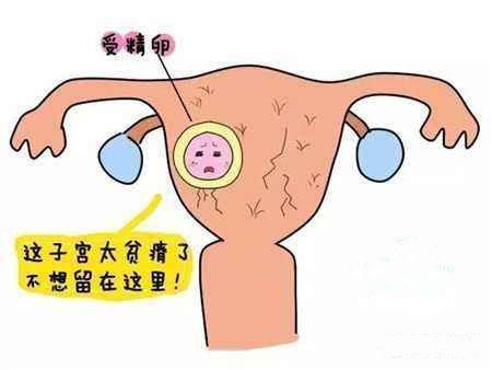 正常子宫宫内膜厚度_子宫没有内膜有月经吗_子宫内膜薄