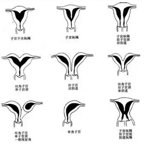 宫腔镜检查_宫腔镜检查?_什么叫宫腔镜检查