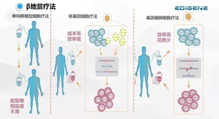 地海中贫血严重会怎样_地中海贫血_地海中贫血有哪些症状