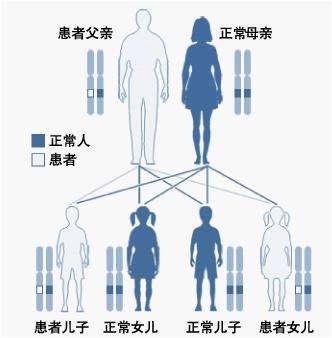 地中海贫血_地海中贫血严重会怎样_地海中贫血有哪些症状