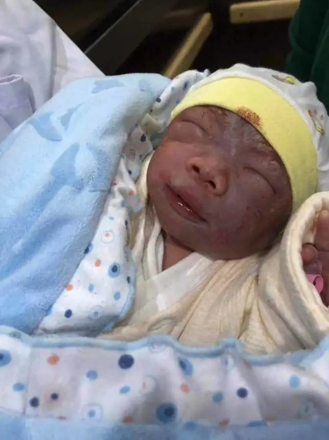 婴儿吃奶时呛奶_婴儿呛奶_婴儿呛奶怎么办