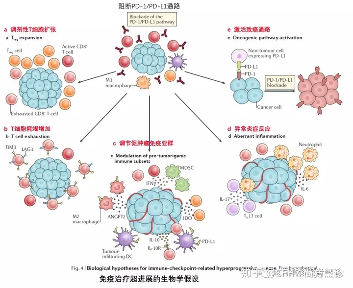 nk细胞偏低_nk t细胞淋巴瘤_nk细胞