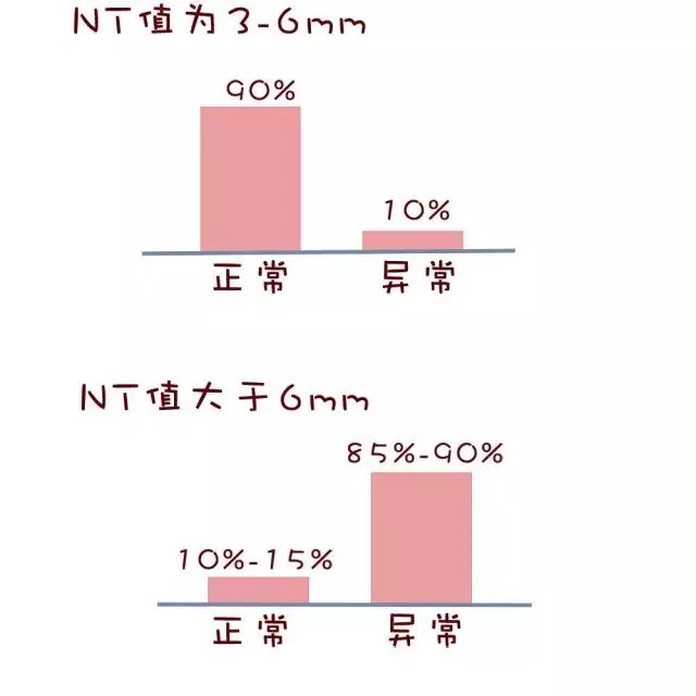 nt检查
