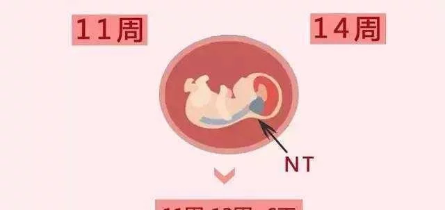 nt检查