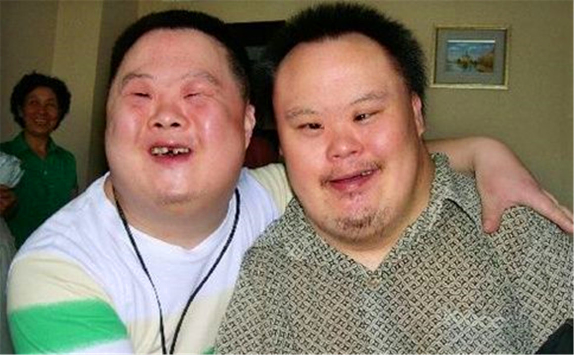 唐氏综合症_囤积症对应的是什么症_唐氏总和症