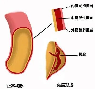 卓艾氏综合症是癌症吗_马凡氏综合症_潘氏马先蒿潘氏亚种