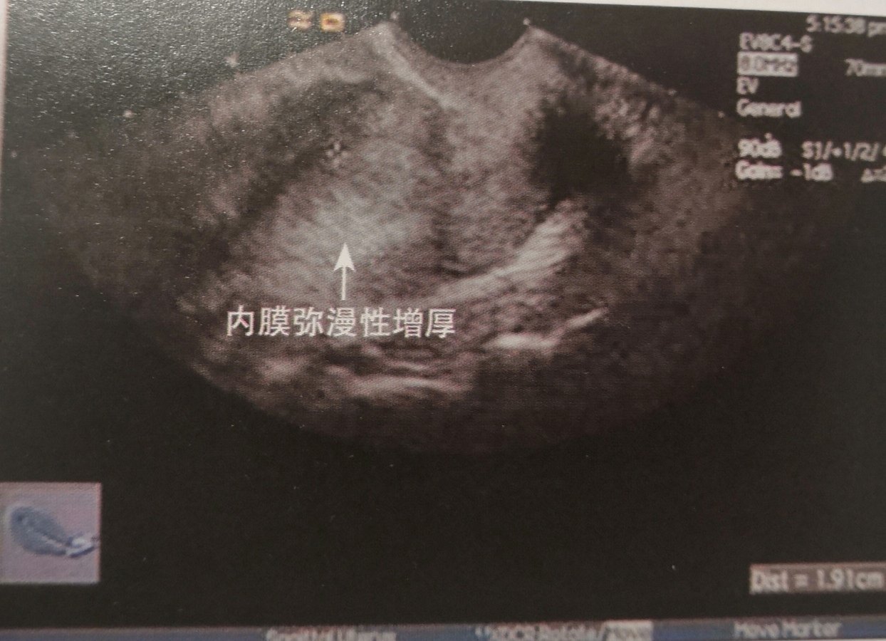 英短蓝猫 尴尬期_哈尔滨市区征地区片综合地价表2011_短QT间期综合征
