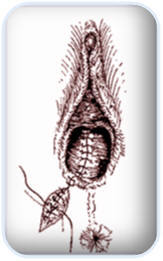 Episio6.jpg