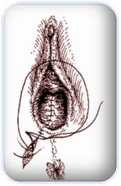 Episio7.jpg