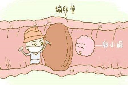 造影疏通输卵管吗_输卵管造影_输卵管超声造影副作用
