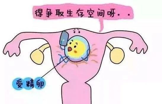 宫腔镜检查?_宫腔镜检查_什么情况做宫腔镜检查