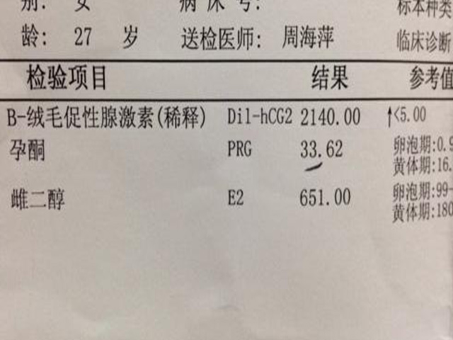 孕酮和雌二醇检查单