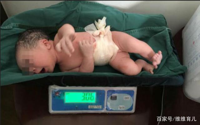 新生儿出生后第一关的筛查项目,妈妈你知道吗(图1) 新生儿检查项目