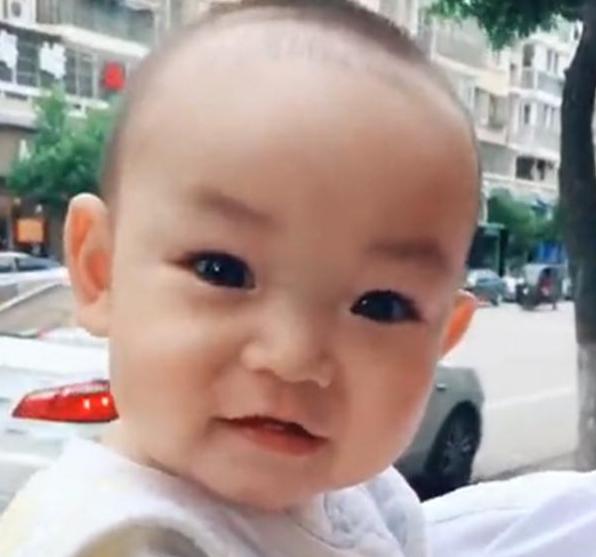 幼儿急疹图片症状_幼儿急疹_幼儿急疹的护理