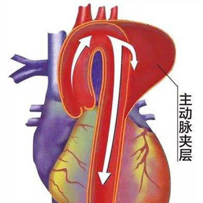 假日综合征和症_潘氏马先蒿潘氏亚种_马凡氏综合症