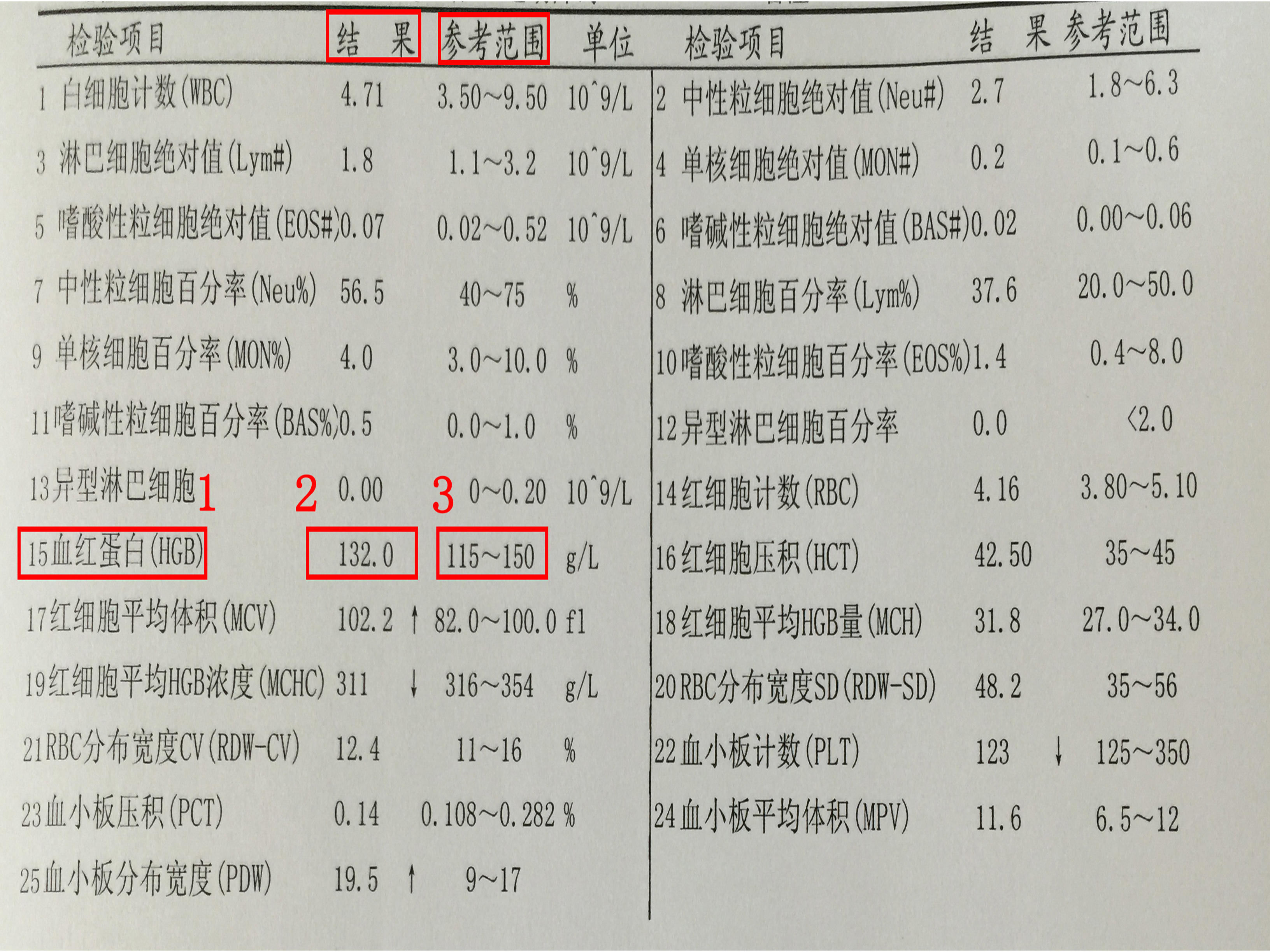 地海中贫血能治好吗_地海中贫血孩子能要吗?_地中海贫血
