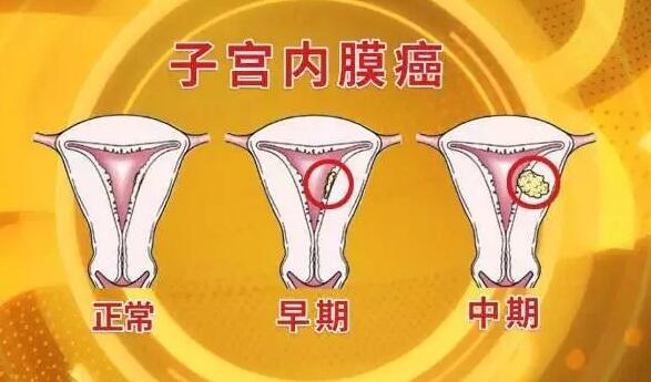 激素六项孕酮低怎么办_雌激素低怎么办_高灵敏促甲状腺激素低