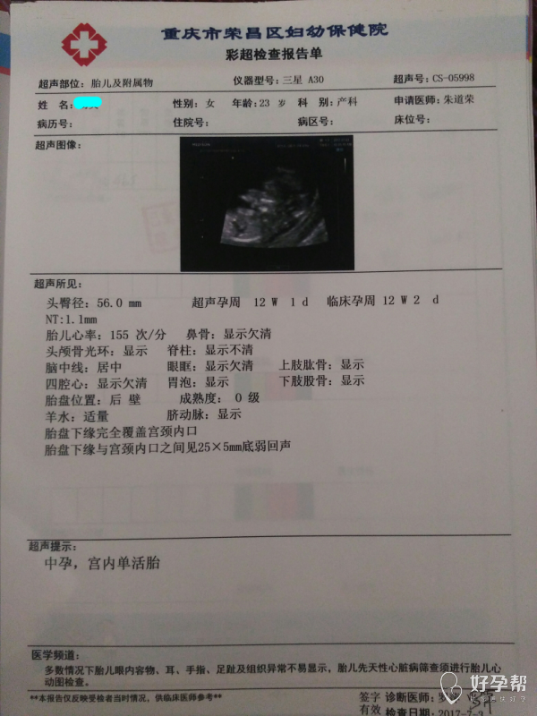 nt检查_nt 检查_nt检查图片
