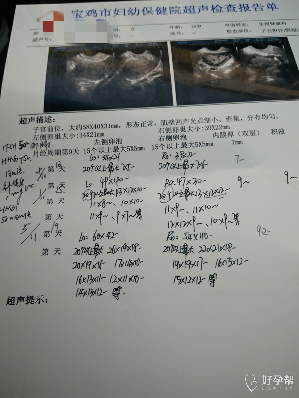 穿刺大卵泡,小卵泡能长大吗_窦卵泡计数_穿刺大卵泡,小卵泡能长大吗