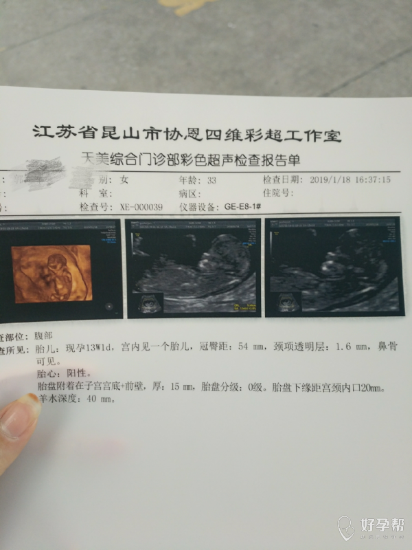 穿刺大卵泡,小卵泡能长大吗_穿刺大卵泡,小卵泡能长大吗_窦卵泡计数