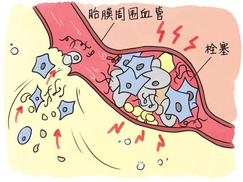 什么是宫腔镜检查_宫腔镜检查_宫腔镜检查后