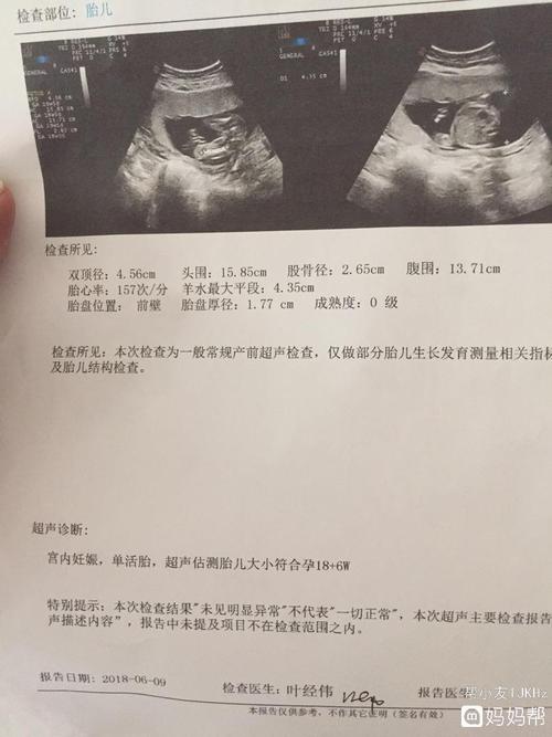 nt检查图片_nt检查_nt检查