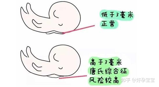 nt检查