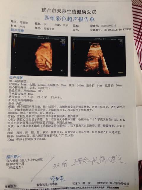 多胎妊娠减胎术步骤_单胎妊娠是什么意思_多胎妊娠