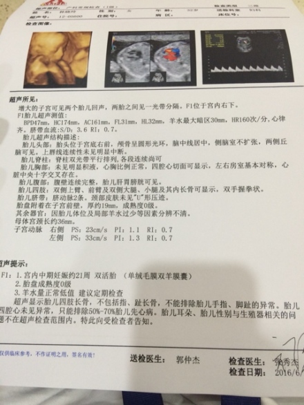 同卵双胞胎女儿