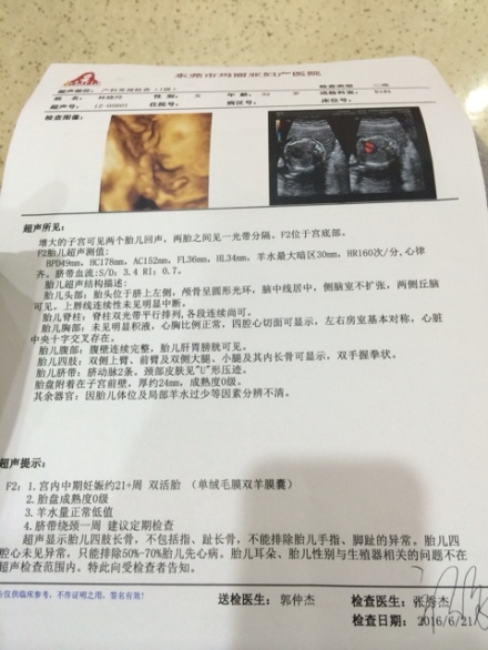 同卵双胞胎女儿