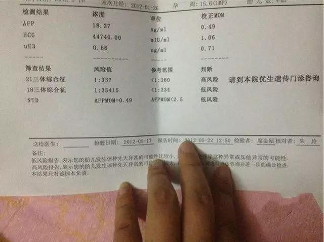 唐氏筛查综合值是1::425,参考值是1:250_唐氏综合筛查是什么_唐氏综合症