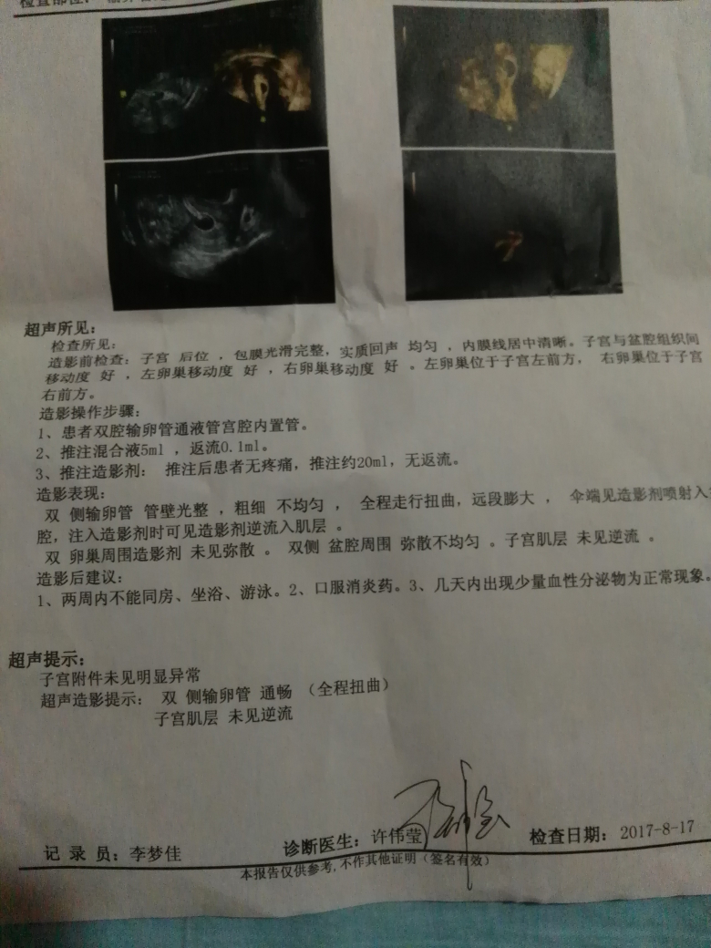 造影可以疏通输卵管吗_输卵管造影_造影疏通输卵管吗
