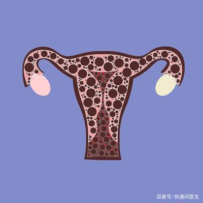 输卵管造影