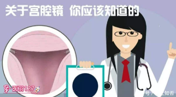 宫腔环境检查