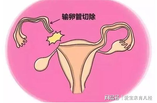 什么是宫腔镜检查_宫腔镜检查后_宫腔环境检查