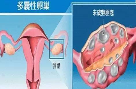 雌二醇_雌二醇偏高_17β-雌二醇 和β-雌二醇 的区别